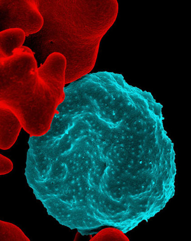 Tiny parasites, huge problem: malaria parasites (blue) infect a human red blood cell.: Photograph courtesy of NIH